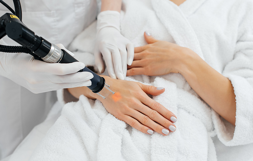 Tratamento das mãos (biostimuladores, laser)
