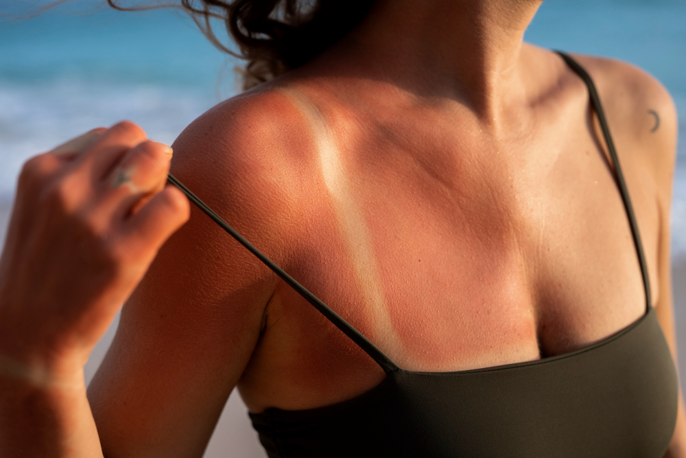 A importância de proteger a pele do sol
